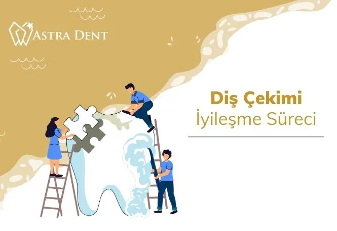 Diş Çekimi İyileşme Süreci - Astradentclinic com