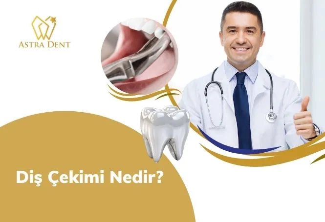 Diş Çekimi Nedir? - Astradentclinic com