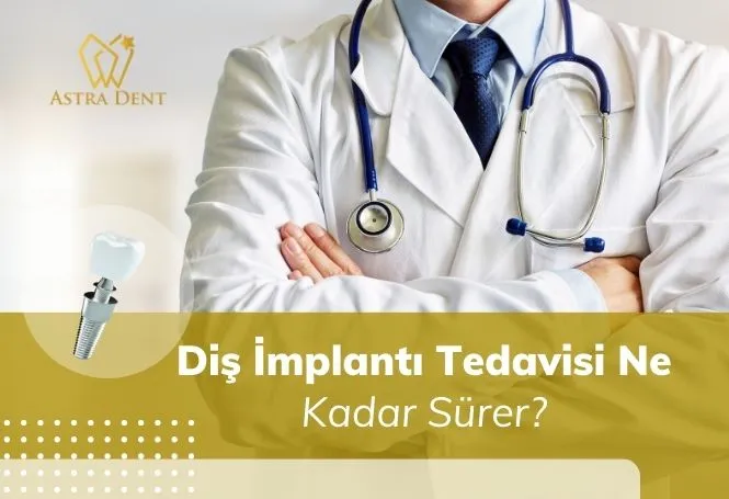 Diş İmplantı Tedavisi Ne Kadar Sürer? - Astradentclinic com