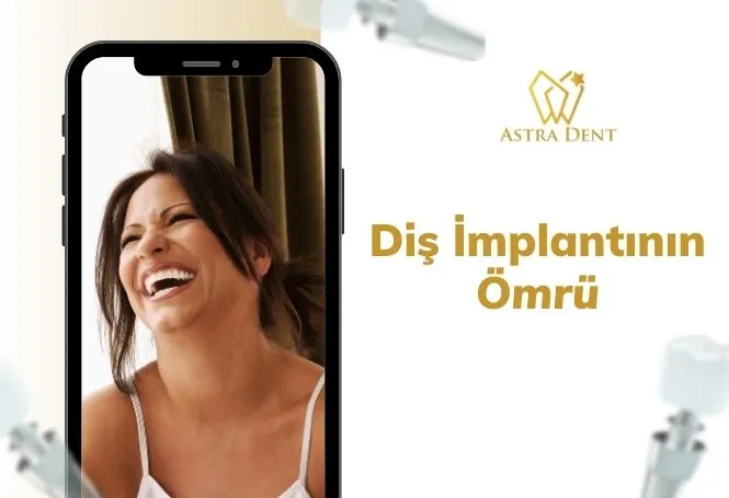 Diş İmplantının Ömrü - Astradentclinic com