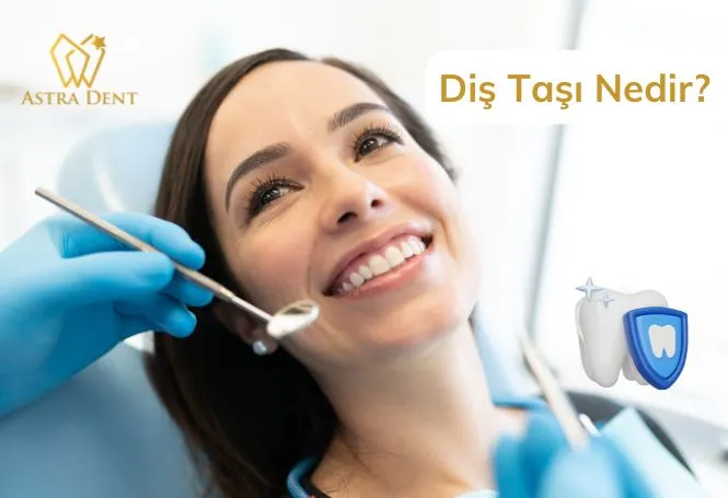 Diş Taşı Nedir? - Astradentclinic com