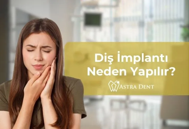 Diş İmplantı Neden Yapılır - Astradentclinic com