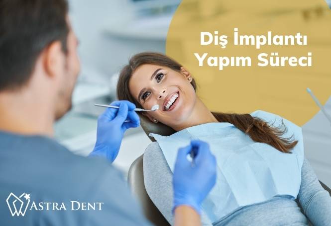 Diş İmplantı Yapım Süreci - Astradentclinic com