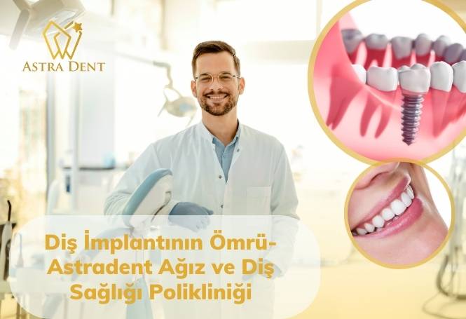 Diş İmplantının Ömrü- Astradent Ağız ve Diş Sağlığı Polikliniği - Astradentclinic com